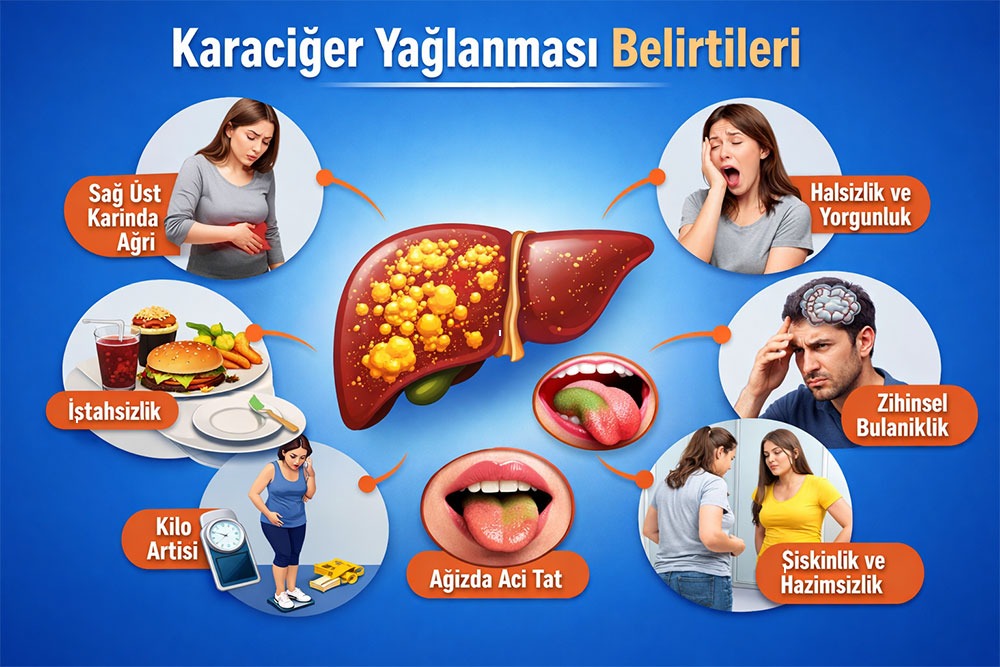 Karaciğer yağlanması belirtileri
